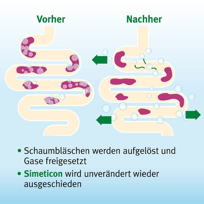 Espumisan Gold Perlen gegen Blähungen (Medizinprodukt), 40 St. Kapseln