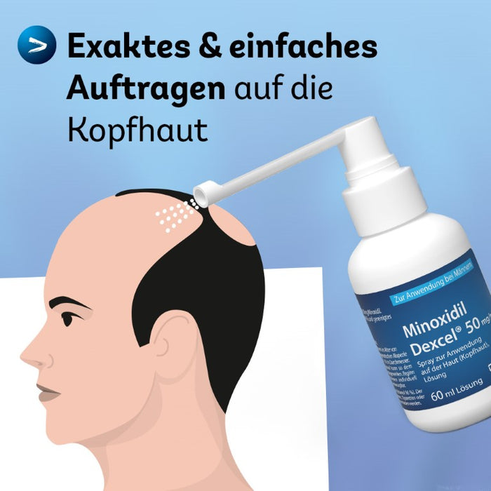 Minoxidil Dexcel 50 mg/ml Spray für Männer zur Anwendung auf der Haut (Kopfhaut), 60 ml Solution
