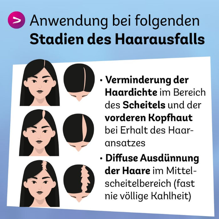 Minoxidil Dexcel 20 mg/ml Spray für Frauen zur Anwendung auf der Haut (Kopfhaut), 60 ml Solution