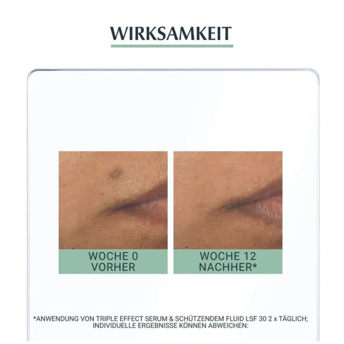 Eucerin Dermopure Triple Effect Gesichtsserum gegen unreine Haut, Pickelmale und glänzende Haut, 40 ml Lösung