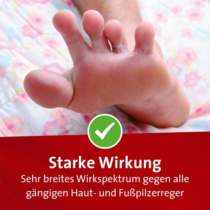 Mykosert Spray bei Haut- und Fußpilz, 60 ml Solution